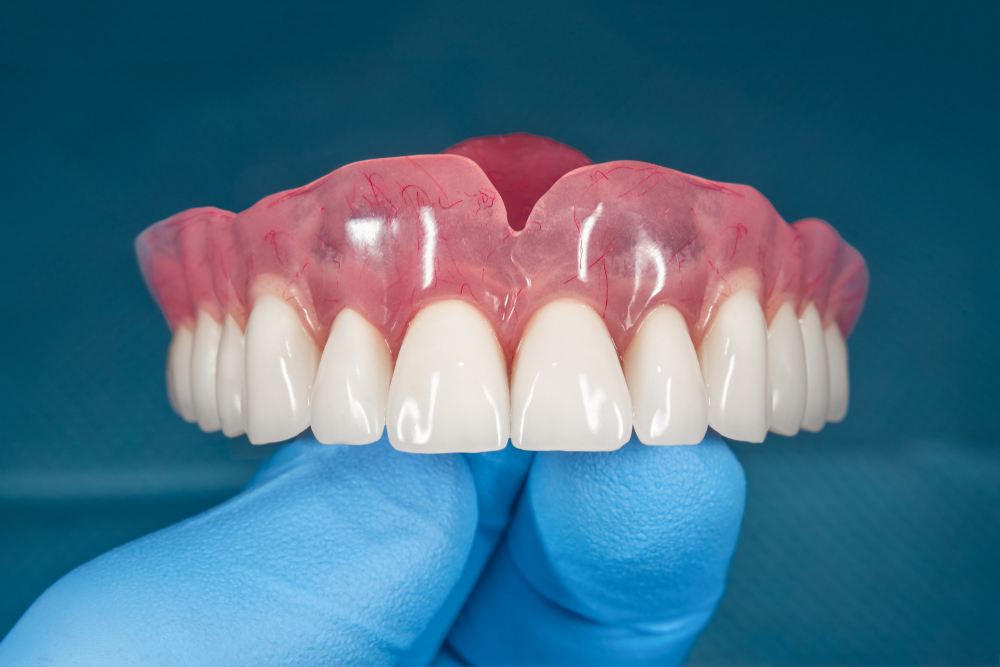 Prótese dentária em zircônia: quando usar?