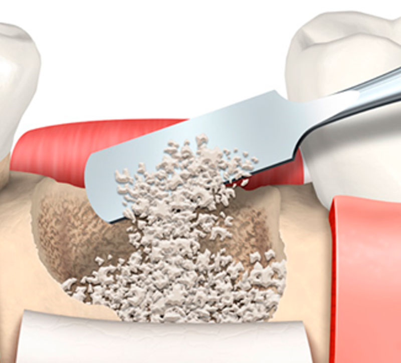 Periodontia e cirurgias periodontais estÃ©ticas